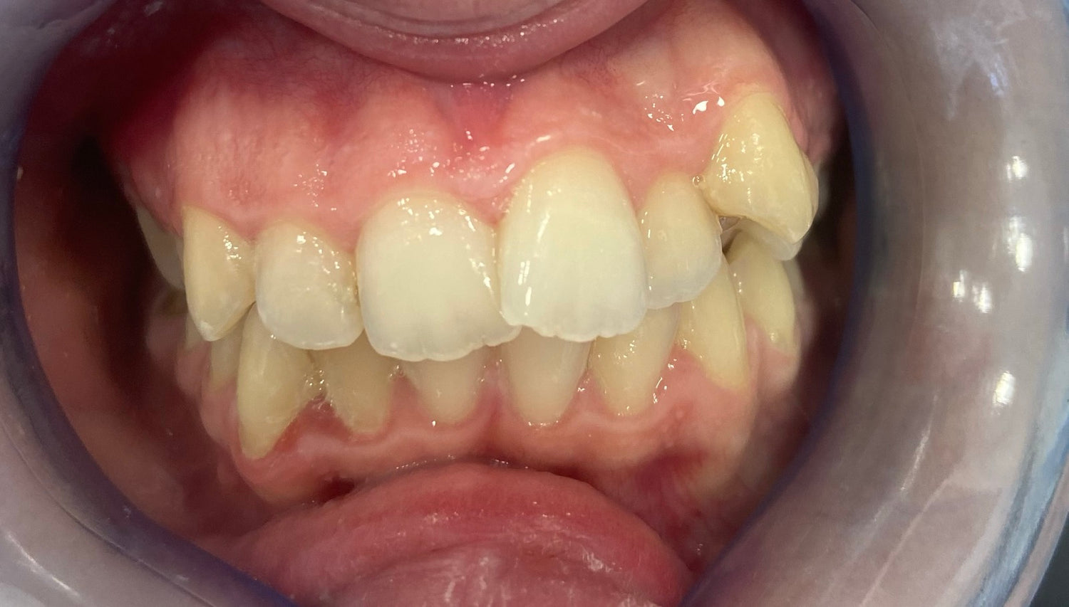 image comparison before