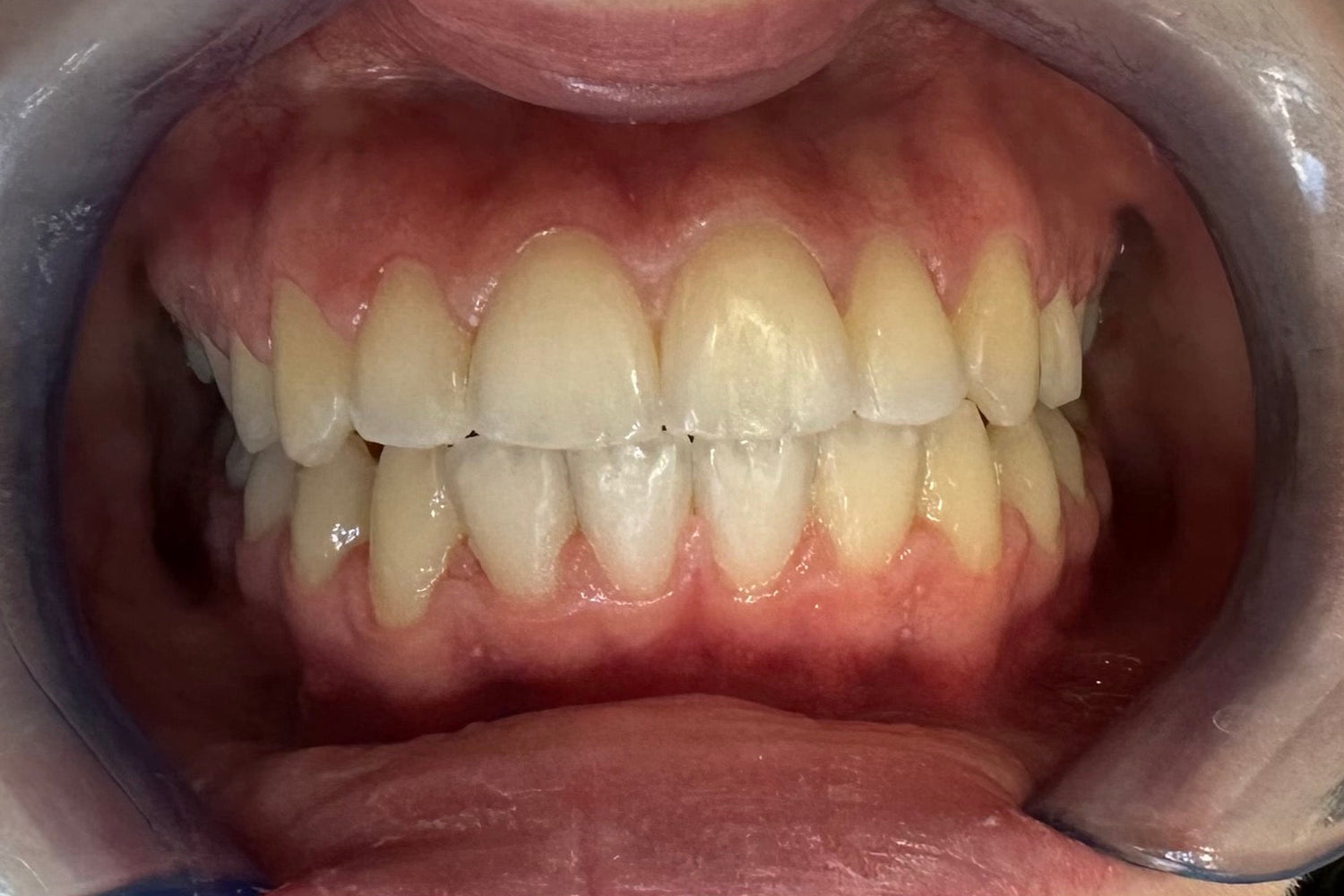 image comparison after