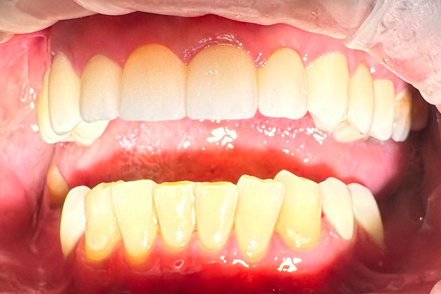 image comparison after