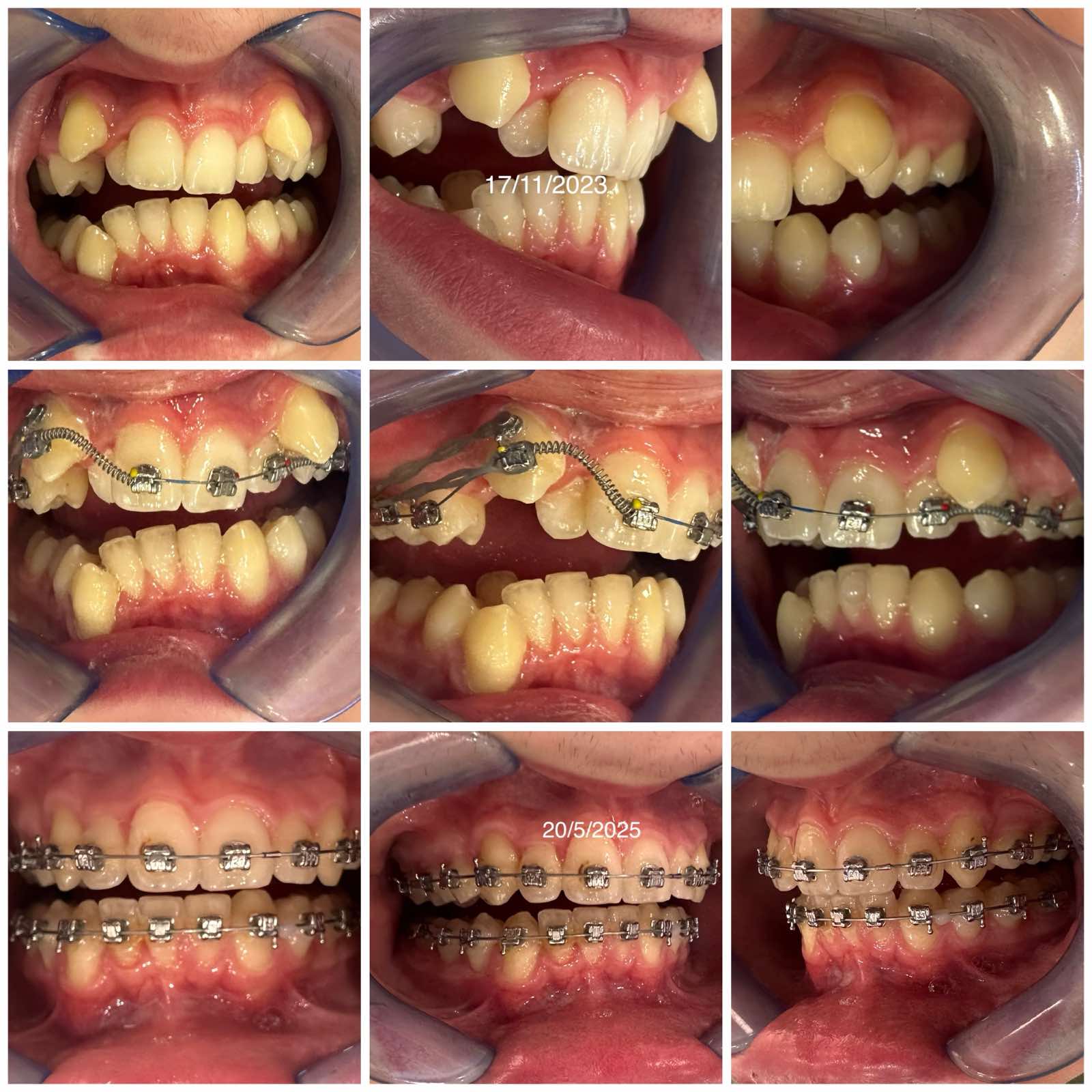 slider image slider_item_34FU6K